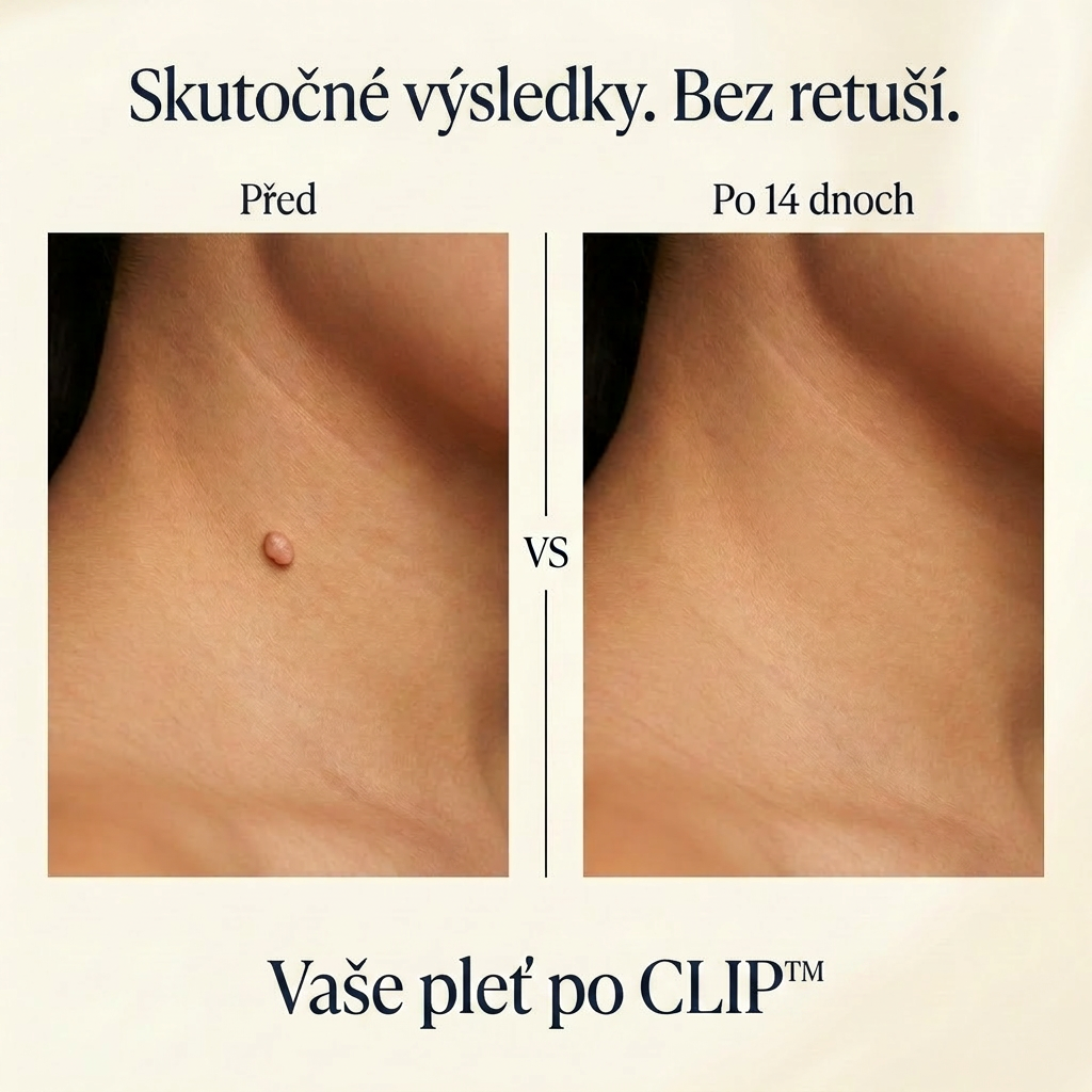 CLIP